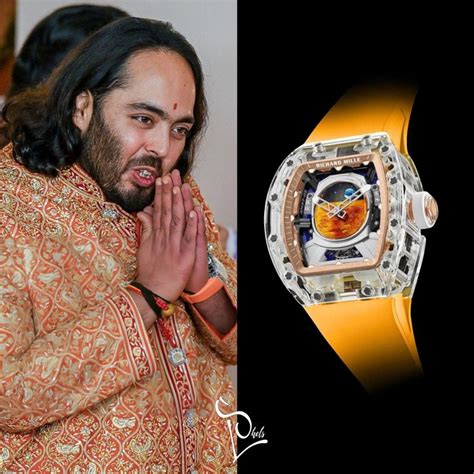 anant ambani watch collection.